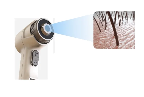 Skin and hair analyzer