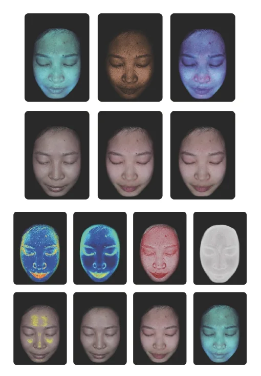 Skin-analysis report examples